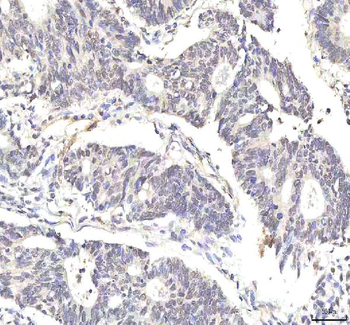 Anti-PHF6 Antibody