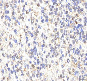 Anti-PHF6 Antibody