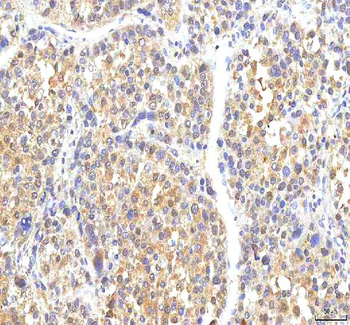 Anti-PHF6 Antibody