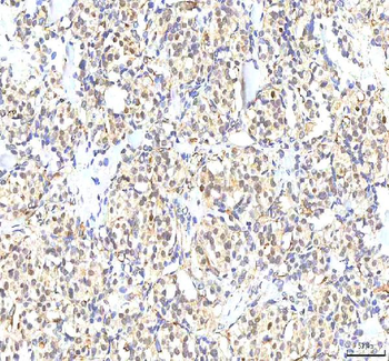 Anti-PHF6 Antibody