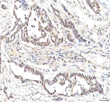 Anti-PHF6 Antibody