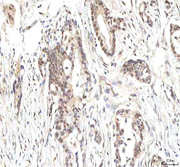 Anti-PHF6 Antibody
