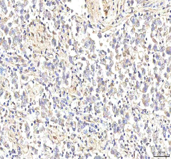 Anti-PHF6 Antibody