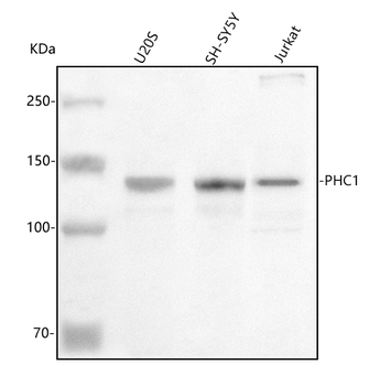 Anti-PHC1 Antibody
