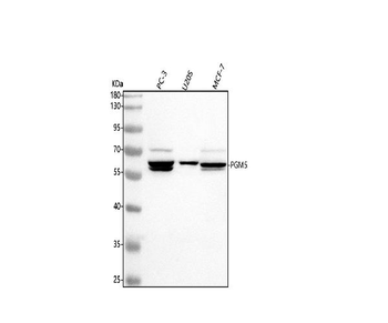 Anti-PGM5 Antibody