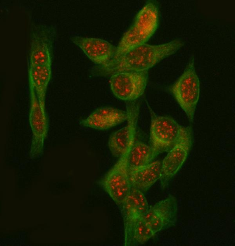 Anti-PGM3 Antibody