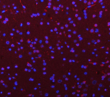 Anti-PGM3 Antibody
