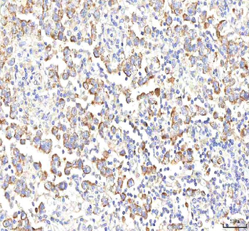 Anti-PGM3 Antibody