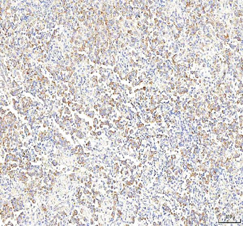 Anti-PGM3 Antibody