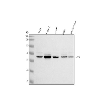 Anti-PGM3 Antibody