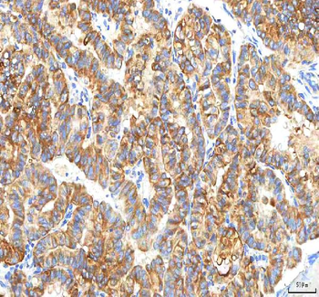 PFKP Antibody