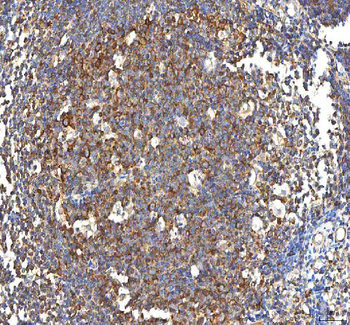 PFKP Antibody