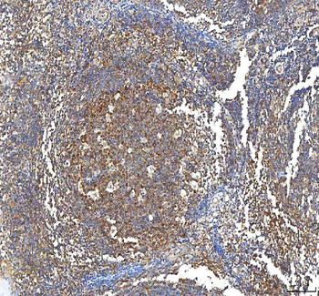 PFKP Antibody