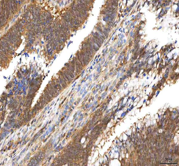 Anti-PDXK Antibody