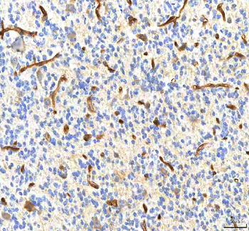 Anti-PDXK Antibody