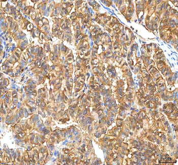 Anti-PDXK Antibody