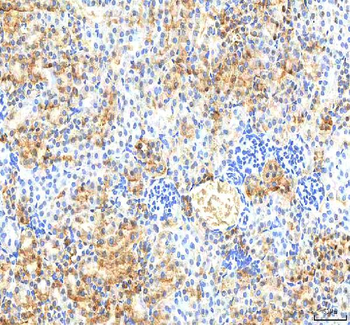 Anti-PDXK Antibody