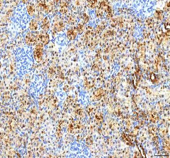 Anti-PDXK Antibody