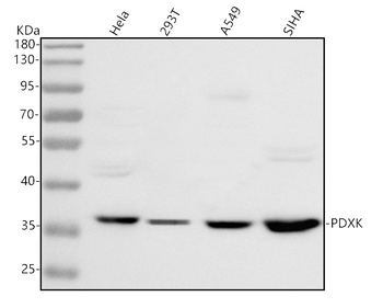 Anti-PDXK Antibody