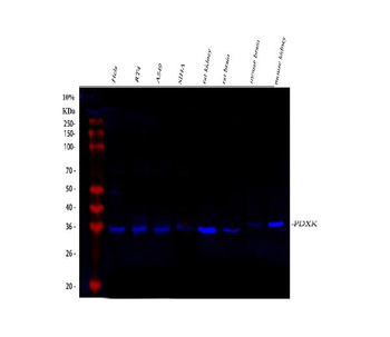 Anti-PDXK Antibody