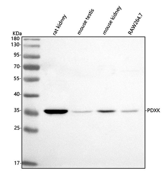 Anti-PDXK Antibody