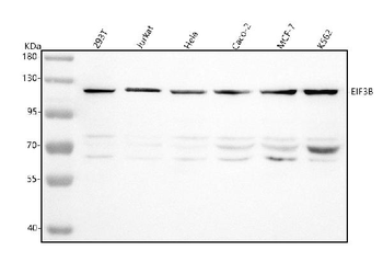 Anti-EIF3B Antibody