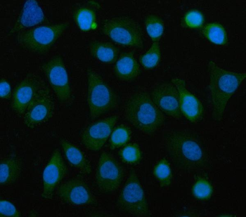 Anti-EIF3B Antibody