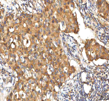 Anti-EIF3B Antibody