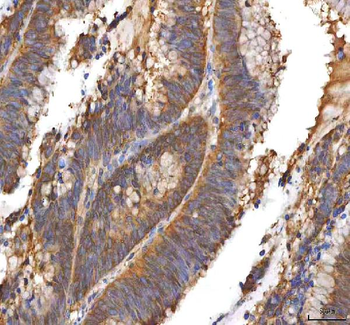 Anti-EIF3B Antibody