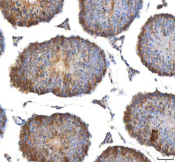 Anti-EIF3B Antibody