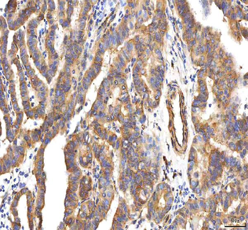 Anti-PCOLCE Antibody