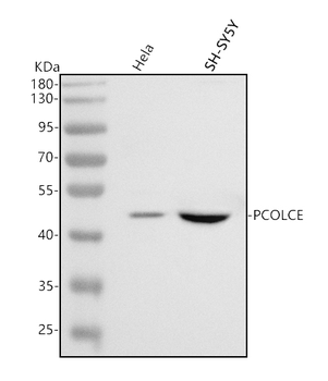 Anti-PCOLCE Antibody