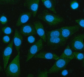 Anti-PCMT1 Antibody