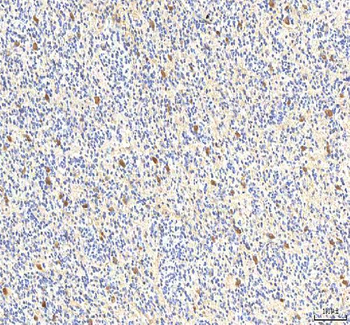 Anti-PCMT1 Antibody