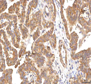 Anti-PCMT1 Antibody