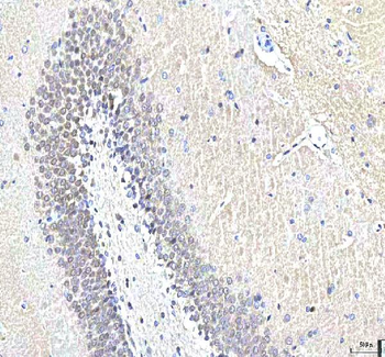 Anti-PCMT1 Antibody