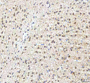 Anti-PCMT1 Antibody
