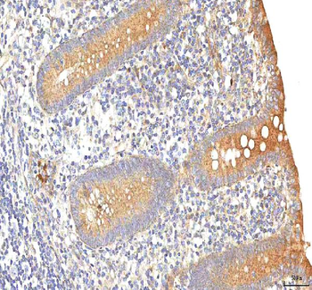Anti-PCDHB14 Antibody