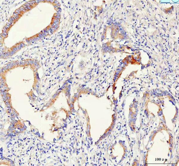 Anti-PCDHB14 Antibody