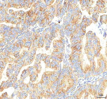 Anti-PCDHB14 Antibody