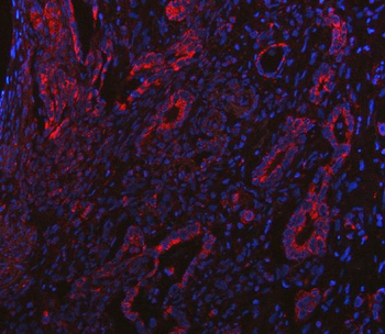 Anti-BCAT2 Antibody