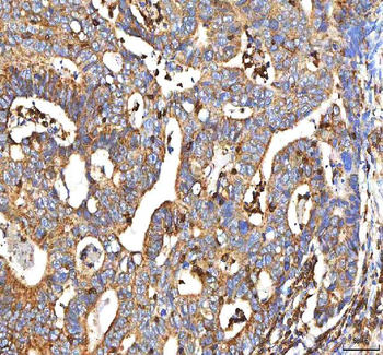 Anti-BCAT2 Antibody