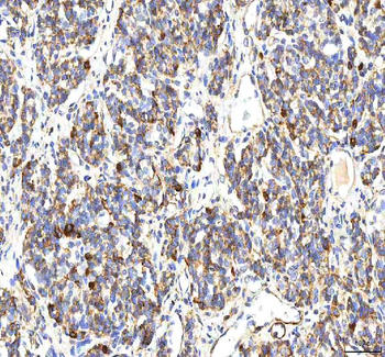 Anti-BCAT2 Antibody