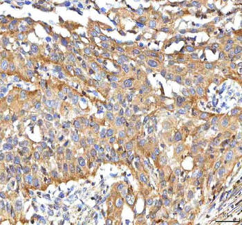 Anti-BCAT2 Antibody