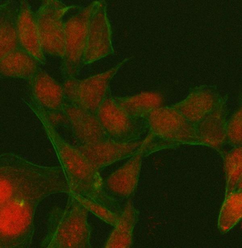 Anti-PATZ1 Antibody