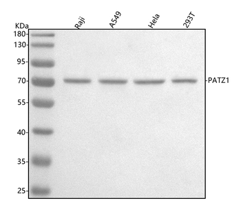 Anti-PATZ1 Antibody