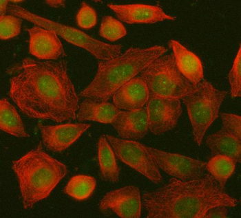 Anti-ING5 Antibody