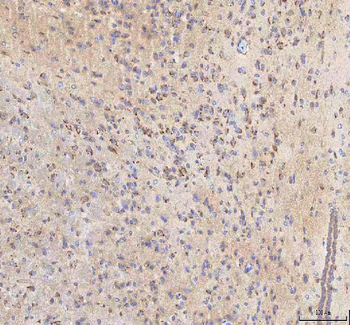Anti-BPNT2 Antibody