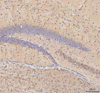 Anti-BPNT2 Antibody
