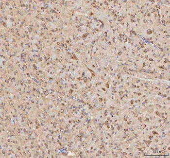 Anti-BPNT2 Antibody